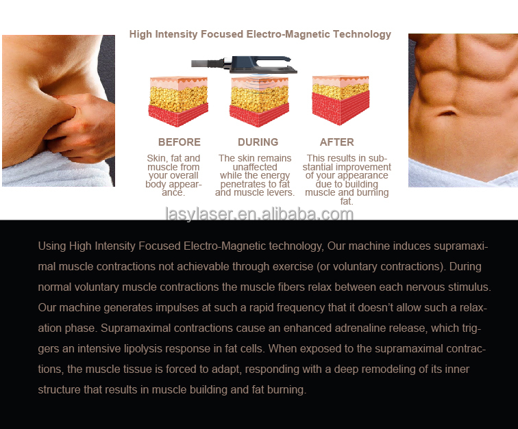 Circslim Aesthetics Body Sculpting Machine , Tesla Hiemt Body Sculpt Machine