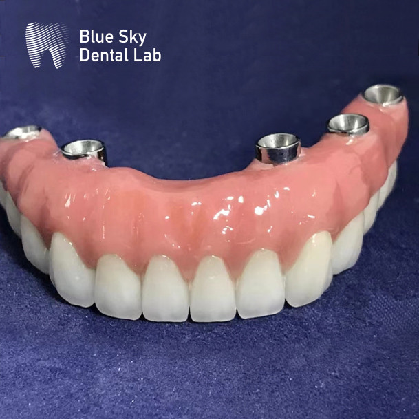 Implantation Cases Artificial Implantation Cases for Seamless System Compatibility