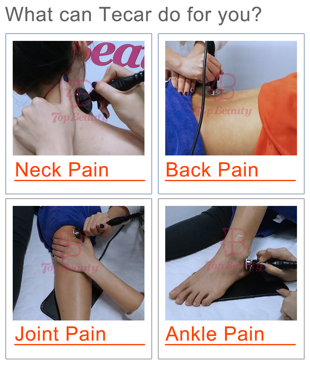 Tecar 3.0 Touch Screen RET CET FR Physio Therapy Machine For Commercial