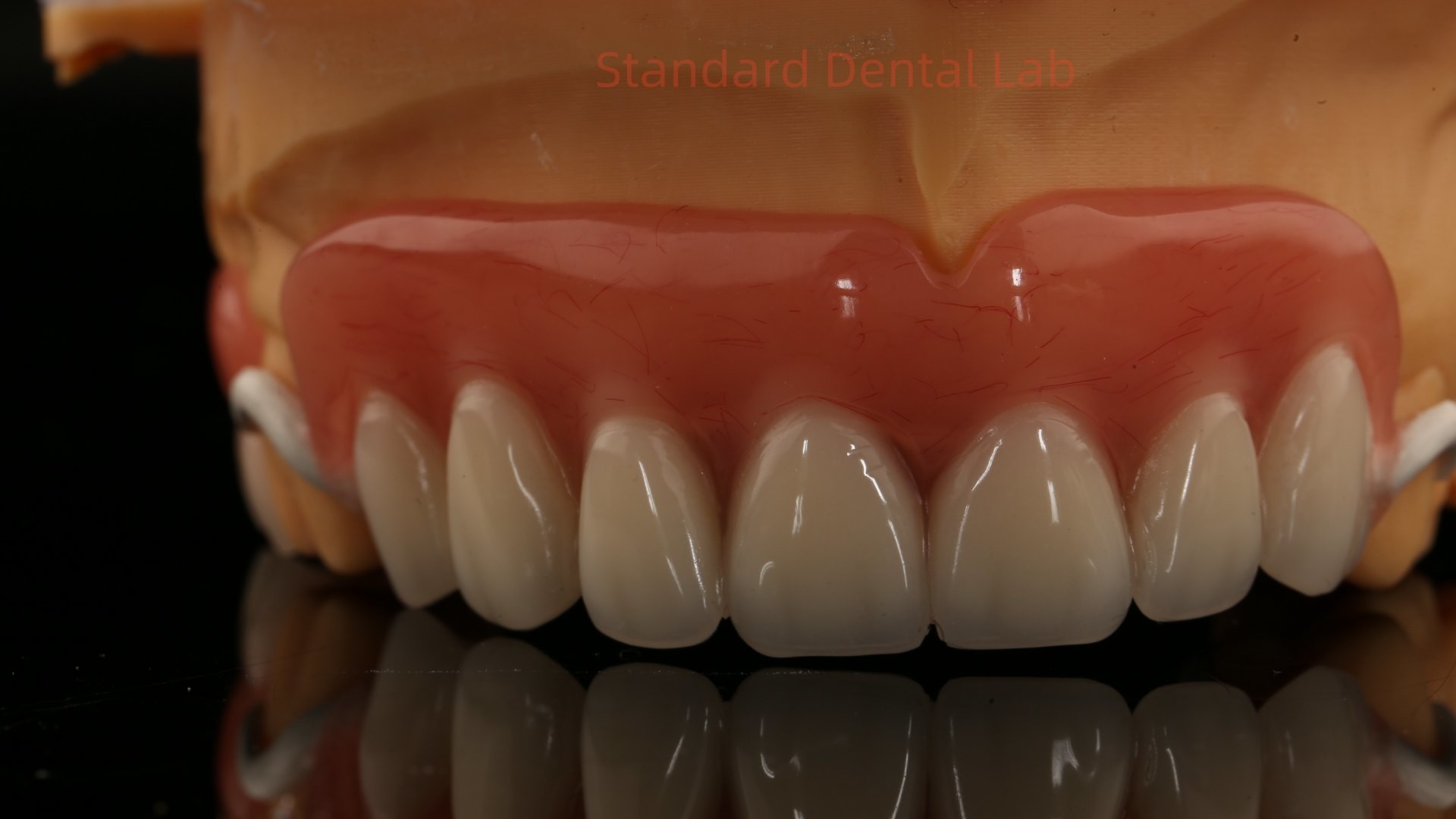 Peek Partial Framework Design ISO CE And FDA Dental Lab Acrylic Partial Denture Framework