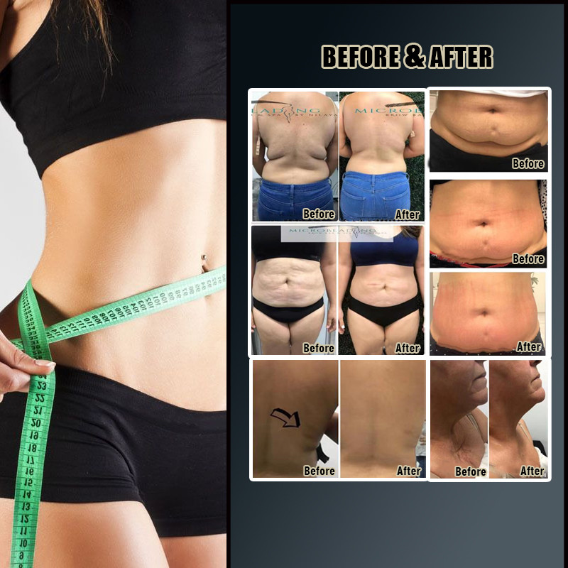 Roller Massage Body Contouring Vela Shape Machine