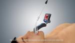 Reusable Anesthesia Video Laryngoscope Airway Intubation With Enhanced View