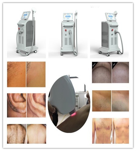 Buy CE approved new laser diode 808nm products laser hair removal training Nubway 808 diode laser for sale at wholesale prices