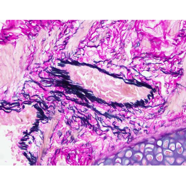 Elastic Fiber Stain (Victoria blue Method) -Elastin stain Baso Clear Colourful Stains