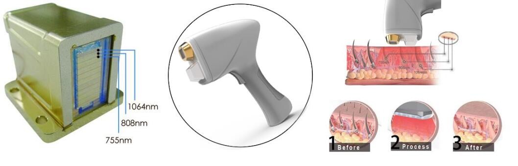 10hz Lasertell Triple Wave Diode Laser Hair Removal