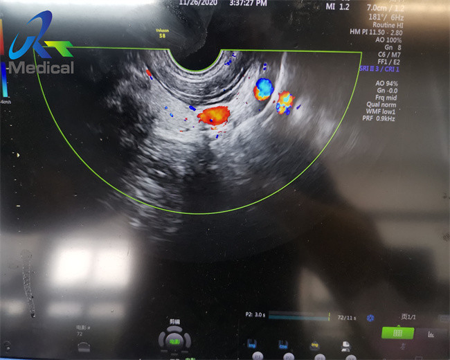 GE IC9-RS Endocavity Ultrasound Transducer Probe Ultrasound Machine