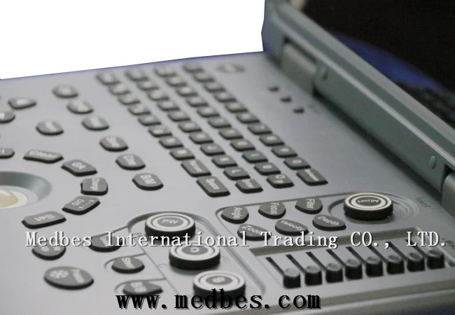 15-Inch Full Digital Color Doppler Ultrasound System