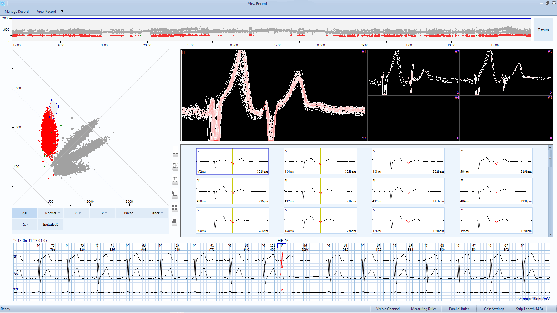 EDAN SE-2012 ECG 3 Channel 12 channel Holter Up to 8 days cable heart rate monitor
