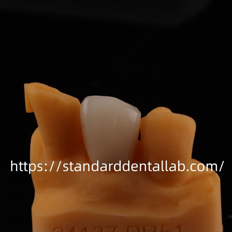 Full Contour Dental Lab Crowns High Translucency Solid Zirconia Crown China Dental Lab