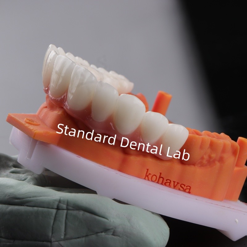 Good Fitting Precise Esthetic Zirconia Porcelain Crown Pink Porcelian With Bleaching Shade