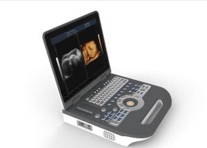 Quality Medical Ultrasound Machine Portable Ultrasound Scanner 4d Ultrasound Equipment for sale