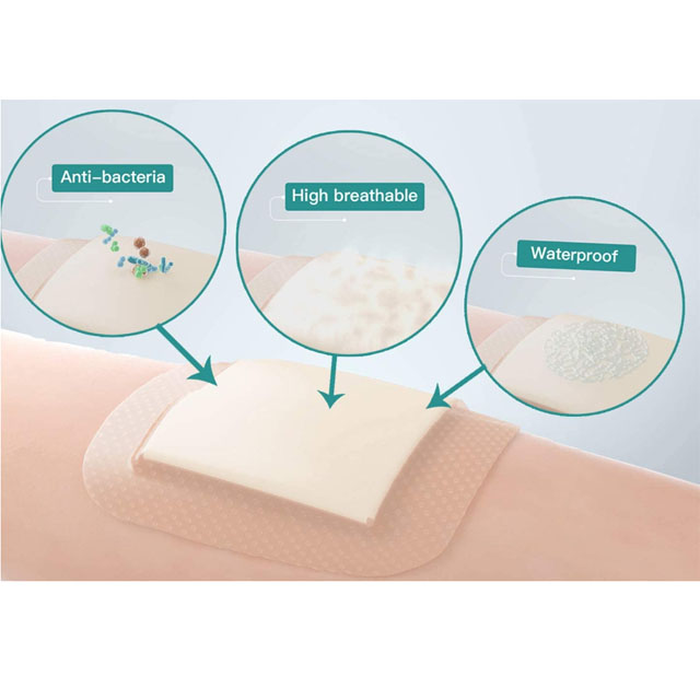 4"*4" Border Silicone Foam Dressing bedsore dressing