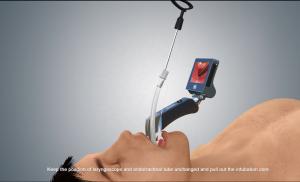 Quality 100mm Surgical Endoscopevideo Laryngoscope With Reusable Blades for sale