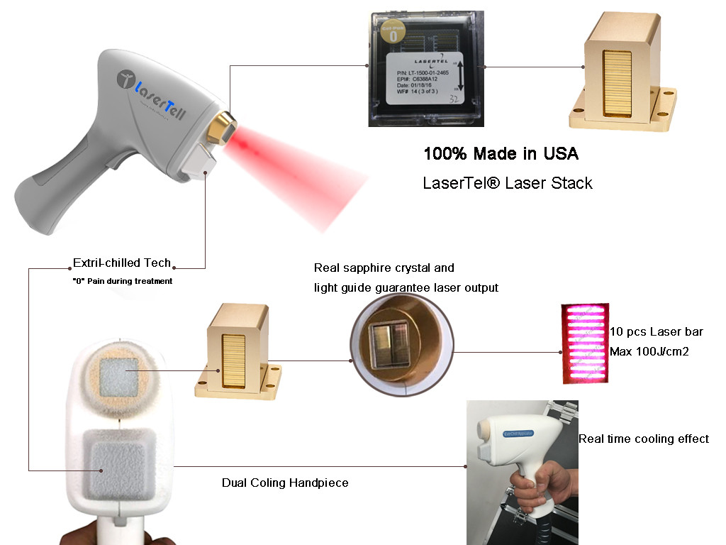 10-400ms Pulse Width 808nm Hair Removal Machine 1 Year Warranty For Aesthetic