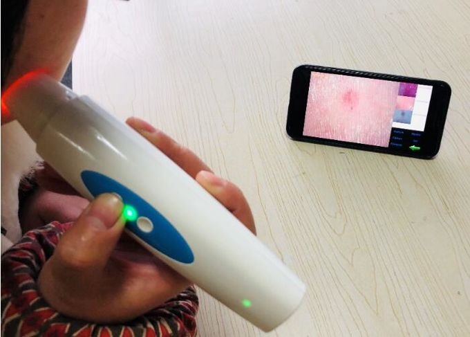 Handheld Digital Skin Analyzer 50 Times Lense For Skin And 200 Times Lense For Scalp