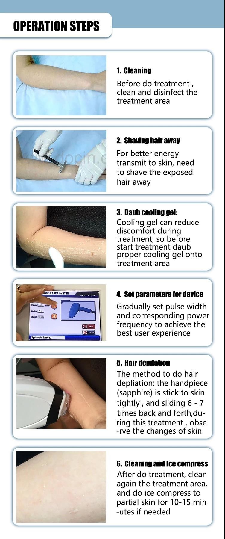 diode laser 808nm hair removal machine for sale / 808nm diode hair removal laser equipment LF-647A
