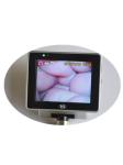 Portable Handheld Anesthesia Adult Pediatric Video Laryngoscope Medical