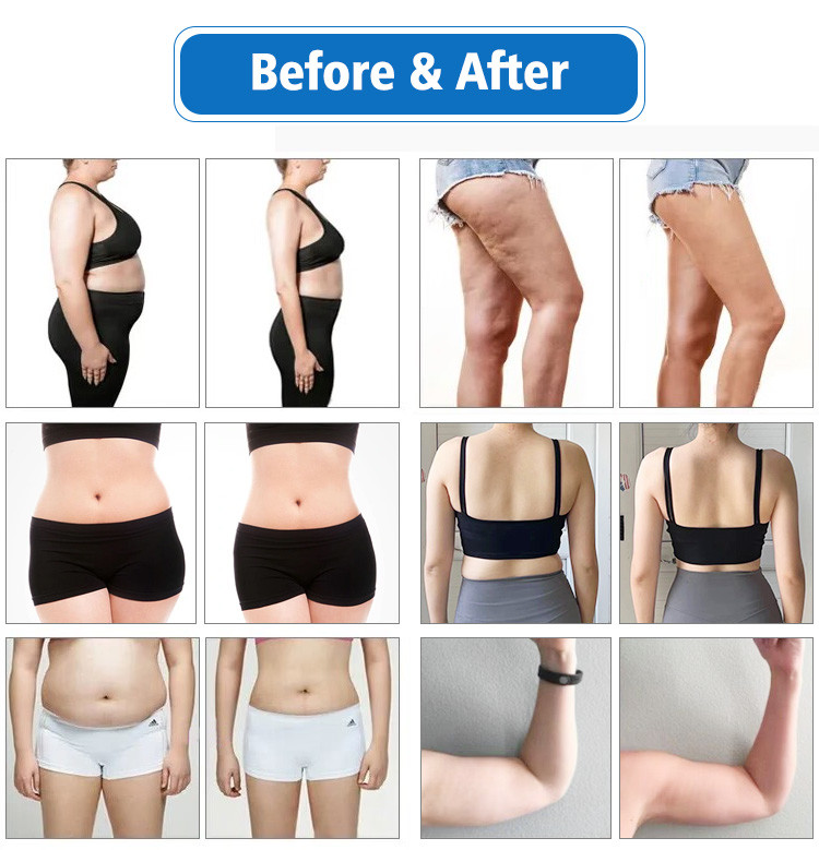 10D Maxlipo Master Laser Weight Loss Machine , EMS Cryo Weight Loss Machine 1100W