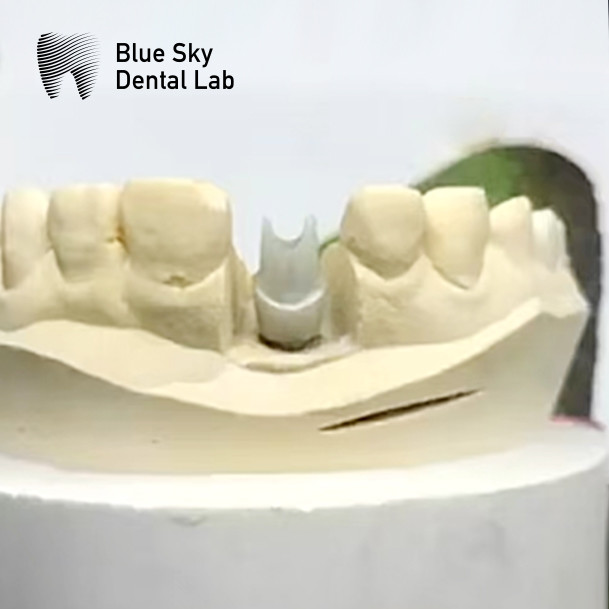 White Milled Zirconia Abutment For Single Or Multiple Teeth Restorations