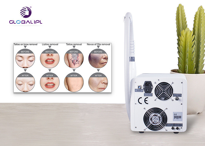 Tattoo Removal Q Switched Nd Yag Laser 1 To 6Hz Frequency 220V / 110V Voltage