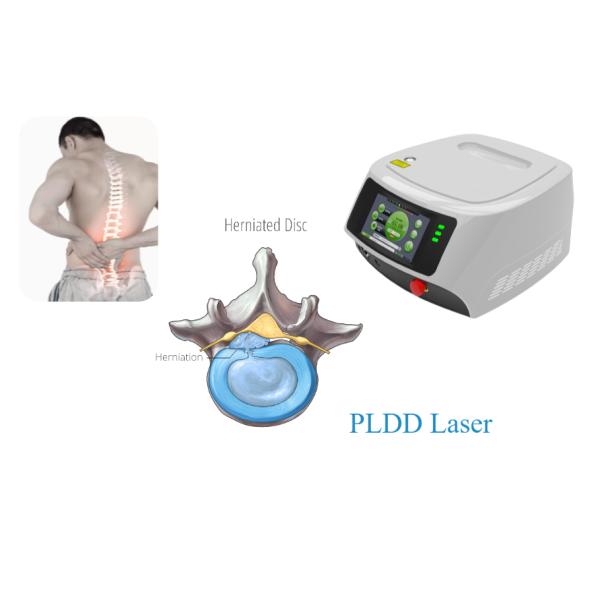 CW Mode PLDD Laser Machine Spinal Disc Decompression 1470nm