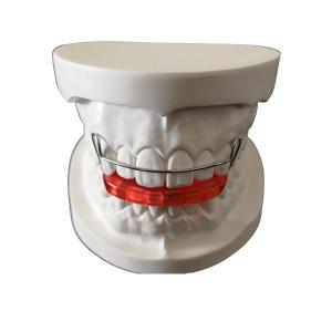 Custom OEM Tooth Positioner Orthodontics Simple Install Easy Maintain
