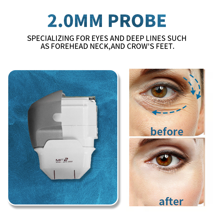 Manufacturer Portable HIfu 7D Machine With 9 cartridges /mmfu Face Lift Beauty Equipment