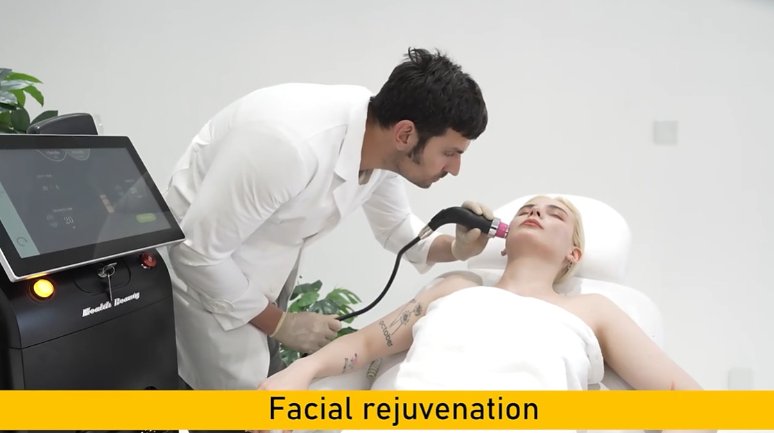 2026 Portable Diode Laser 808nm Painless Hair Removal Nd Yag Pico Laser Tattoo Removal Machine