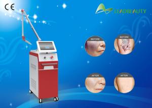China Q-Switched Nd Yag Tattoo Laser Removal Equipment Beauty Machine For Pigment Removal on sale