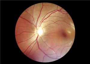 Quality Handheld Digital Fundus Camera for sale