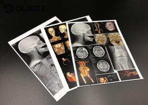 Quality 0.15mm Medical Radiation Printing Film for sale