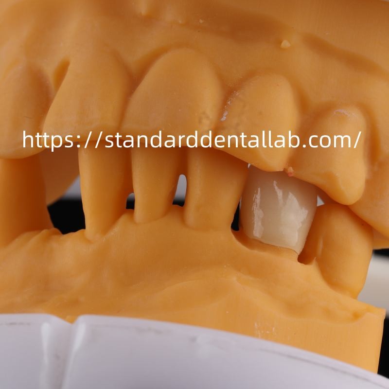 Full Contour Dental Lab Crowns High Translucency Solid Zirconia Crown China Dental Lab