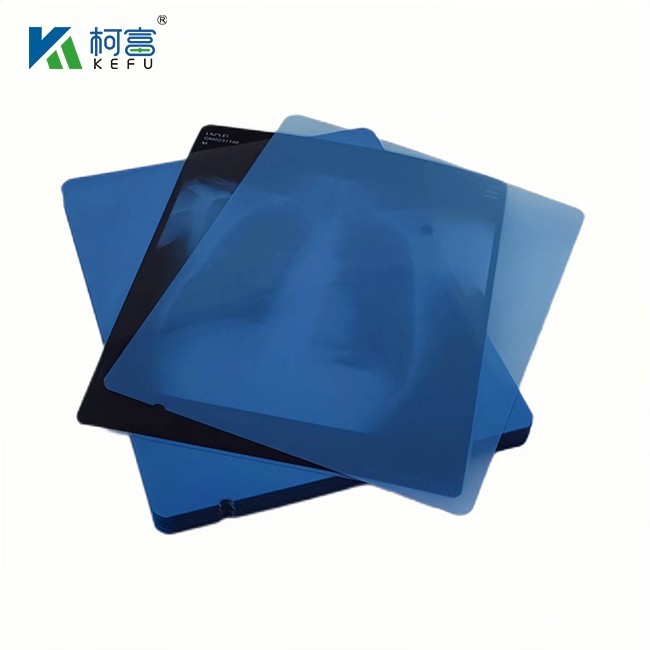 Professional Grade Inkjet Blue Film Blue Medical Film PET X-Ray Film For Medical Imaging Needs