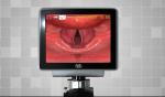 3.0 Inch Rechargeable Medical Video Laryngoscope For Hospital
