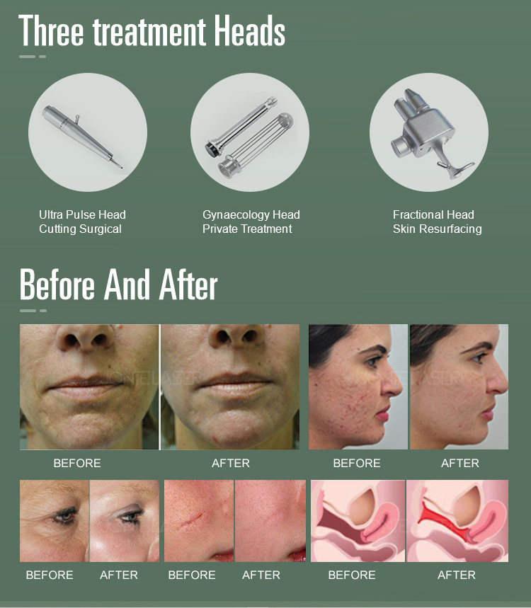 Skin Tightening Clinic Co2 Fractional Laser Machine Air Cooling