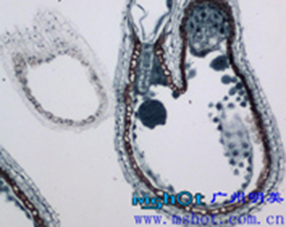 Digital microscope of biological microscope with camera and software