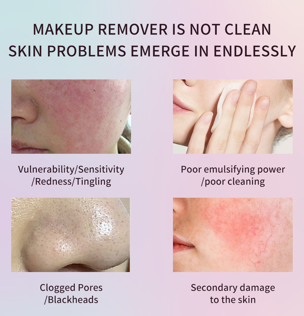 Natural Extract Cucumber Cleansing Water Micellar Water Make Up Remover OEM