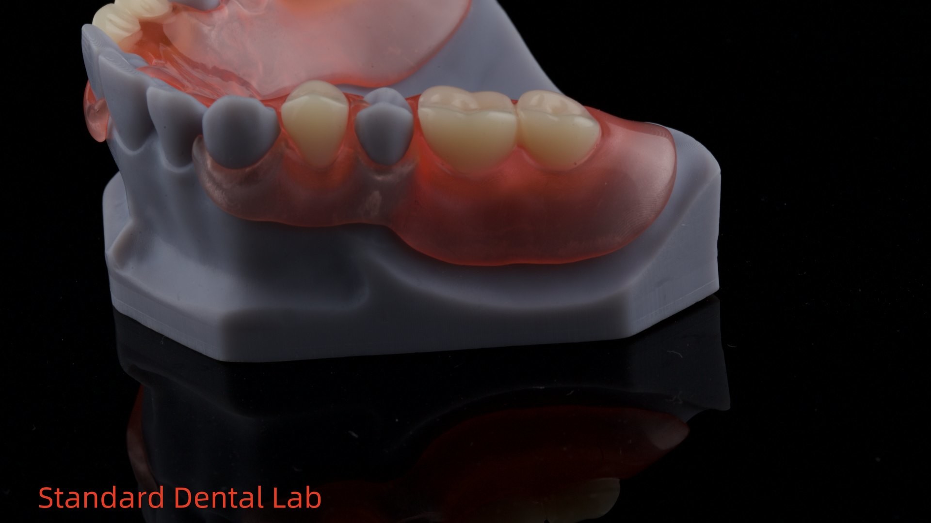 3D Print Model High Esthetics Dental TCS Valplast Flexible Partial Dentures Dental Lab