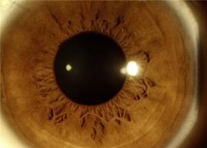 Quality Digital Non Mydryatic Portable Ophthalmic Equipment for sale