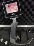 Reusable Anesthesia Video Laryngoscope Airway Intubation With Enhanced View