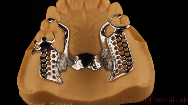 Metal Alloys Partial Cobalt Chrome Dentures Ivoclar Scheftner Comfortable China