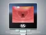 Surgical Operation Portable Medical Handheld Reusable Visual Flexible Video
