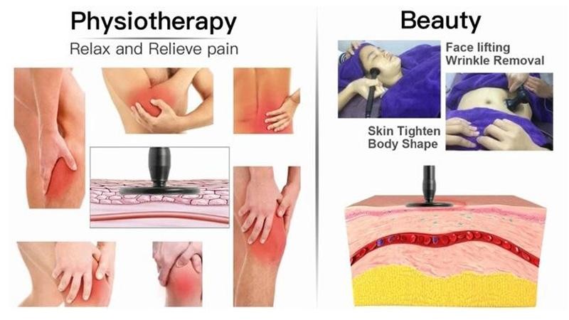 Ret Cet Rf Physiotherapy 448KHZ Tecar Corporal Radiofrequency Machine