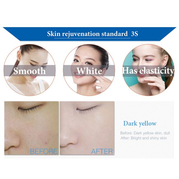 Hydro Oxygen Facial Machine – Easy Operation for Salons & SPA Centers Deep Cleansing + Oxygen Rejuvenation 2 in 1 facial cleaning machine