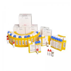 China CNAS Clinical Diagnostic Reagents Chemistry For Renal Clinical Analyzer on sale
