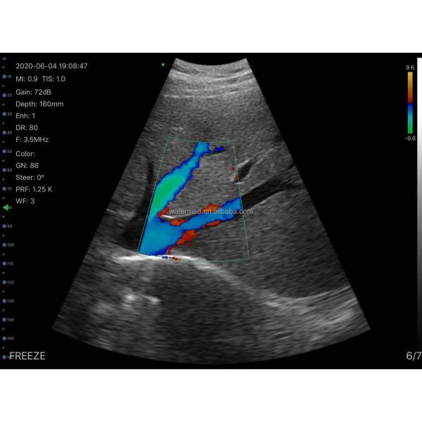 Wireless Android Ultrasound Highest Cost-effective Double Probes Wireless Color Doppler Ultrasound Scanner 3 in 1 Ultrasound
