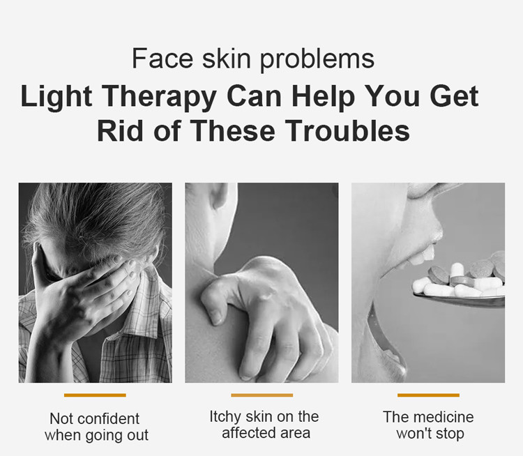 CE ISO LED 311nm Uv Phototherapy Lamp UVB Light Therapy For Psoriasis Vitiligo