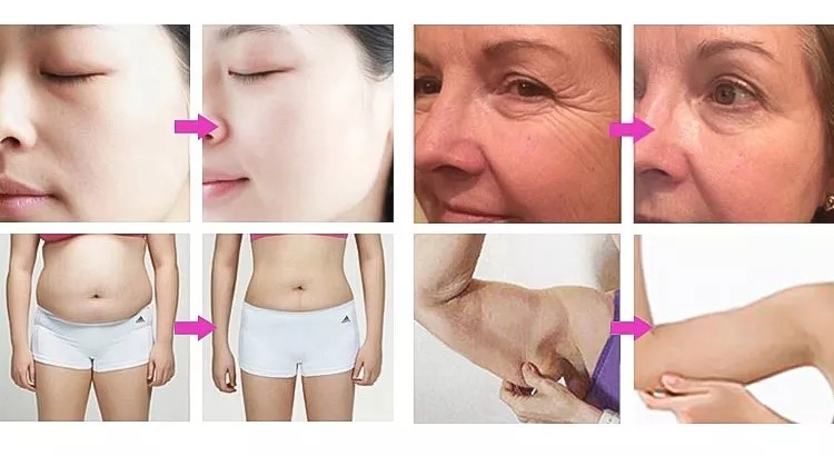 3 In 1 80k Cavitation Fat Burner Fat Reduction Cellulite Removal Rf Face Slimming Massage Machine