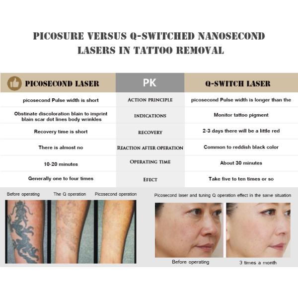 PicoLaser Picosecond Beauty Machine Offering Fine Lines Removal and Skin Whitening with Ultra Short Pulse Laser Technology