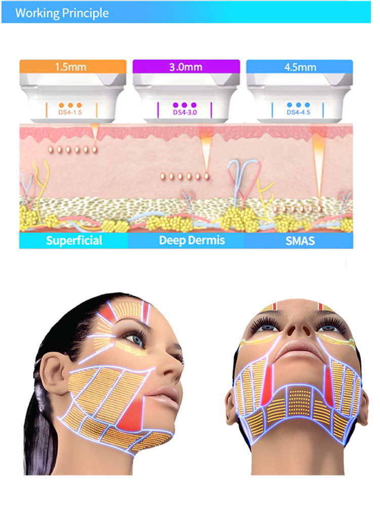 Face Lift Anti Aging 5D HIFU Beauty Machine 2 In 1 High Intensity Focused Ultrasound